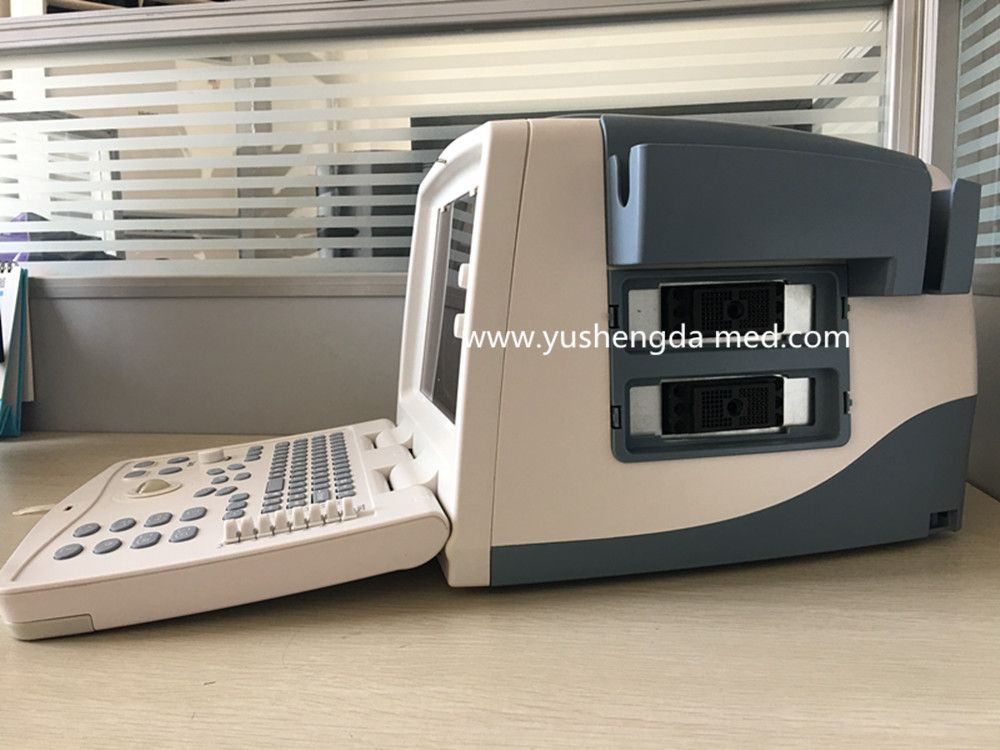 Ce Medical Diagnostic Obstetrics PC Based Digital Portable Ultrasound Scanner